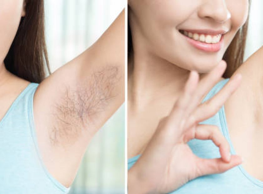 asia beauty woman with armpit plucking problem before and after
