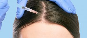 Hair-mesotherapy-in-rasht-1024x448